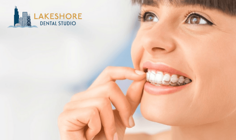 https://www.lakeshoredentalstudio.com/wp-content/uploads/2023/01/63be9abe814110e08ed3362d_How-do-I-clean-my-invisible-clear-aligners-p-800.png