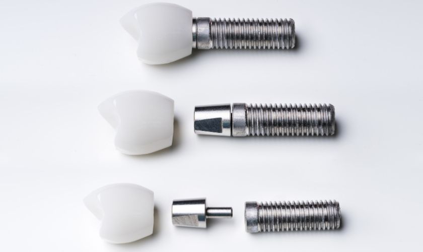 What Are The 3 Stages Of Dental Implant?